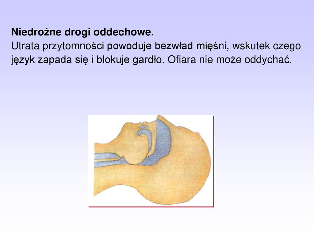 Kurs Stra K W Ratownik W Osp Temat Elementy Pierwszej Pomocy Ppt